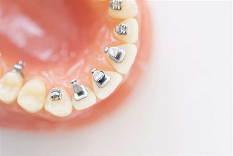 乳歯の時期から口腔環境を整えて健全な成長を後押し